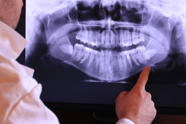 Best Pediatric Emergency Dentist in Dover, TN
