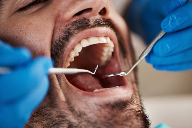 Best Emergency Treatment for Dental Infections or Abscesses in Dover, TN